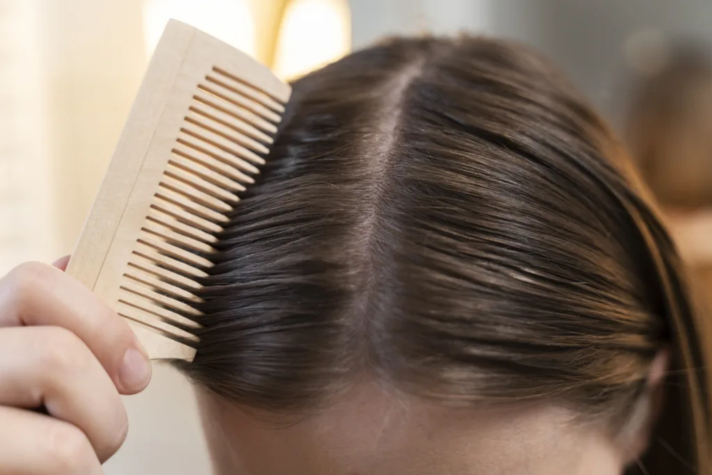 Oily Hair Problem